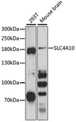 SLC4A10 Antibody - Western blot analysis of extracts of various cell lines, using SLC4A10 antibody at 1:3000 dilution. The secondary antibody used was an HRP Goat Anti-Rabbit IgG (H+L) at 1:10000 dilution. Lysates were loaded 25ug per lane and 3% nonfat dry milk in TBST was used for blocking. An ECL Kit was used for detection and the exposure time was 90s.