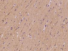 SLC4A10 Antibody - Immunochemical staining of human SLC4A10 in human brain with rabbit polyclonal antibody at 1:100 dilution, formalin-fixed paraffin embedded sections.