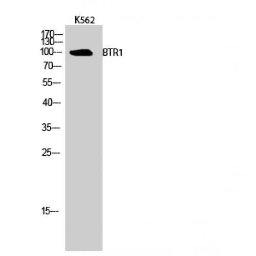 SLC4A11 / NABC1 Antibody - Western blot of BTR1 antibody