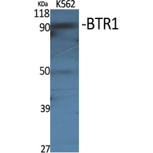 SLC4A11 / NABC1 Antibody - Western blot of BTR1 antibody