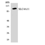 SLC4A11 / NABC1 Antibody - Western blot analysis of the lysates from HT-29 cells using SLC4A11 antibody.