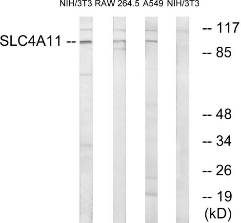 SLC4A11 / NABC1 Antibody - Western blot analysis of lysates from NIH/3T3, RAW264.7, and A549 cells, using SLC4A11 Antibody. The lane on the right is blocked with the synthesized peptide.