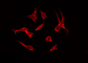SLC4A11 / NABC1 Antibody - Staining NIH-3T3 cells by IF/ICC. The samples were fixed with PFA and permeabilized in 0.1% Triton X-100, then blocked in 10% serum for 45 min at 25°C. The primary antibody was diluted at 1:200 and incubated with the sample for 1 hour at 37°C. An Alexa Fluor 594 conjugated goat anti-rabbit IgG (H+L) Ab, diluted at 1/600, was used as the secondary antibody.