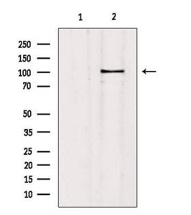 SLC4A11 / NABC1 Antibody - Western blot analysis of extracts of mouse brain tissue using SLC4A11 antibody. Lane 1 was treated with the blocking peptide.