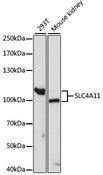 SLC4A11 / NABC1 Antibody - Western blot analysis of extracts of various cell lines using SLC4A11 Polyclonal Antibody at dilution of 1:1000.