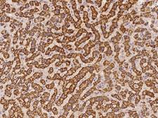 SLC4A1AP / Kanadaptin Antibody - Immunochemical staining of human SLC4A1AP in human liver with rabbit polyclonal antibody at 1:100 dilution, formalin-fixed paraffin embedded sections.