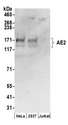 SLC4A2 / AE2 Antibody - Detection of human AE2 by western blot. Samples: Whole cell lysate (50 µg) from HeLa, HEK293T, and Jurkat cells prepared using RIPA lysis buffer. Antibodies: Affinity purified rabbit anti-AE2 antibody used for WB at 0.1 µg/ml. Detection: Chemiluminescence with an exposure time of 30 seconds.