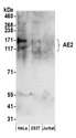 SLC4A2 / AE2 Antibody - Detection of human AE2 by western blot. Samples: Whole cell lysate (50 µg) from HeLa, HEK293T, and Jurkat cells prepared using RIPA lysis buffer. Antibodies: Affinity purified rabbit anti-AE2 antibody used for WB at 0.1 µg/ml. Detection: Chemiluminescence with an exposure time of 3 minutes.