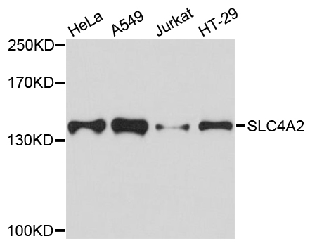 SLC4A2 / AE2 Antibody - Western blot analysis of extracts of various cell lines.
