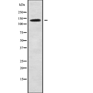 SLC4A2 / AE2 Antibody - Western blot analysis SLC4A2 using Jurkat whole cells lysates