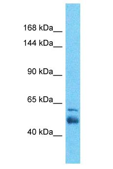 SLC4A3 / AE3 Antibody - SLC4A3 / AE3 antibody Western Blot of Esophagus Tumor. Antibody dilution: 1 ug/ml.  This image was taken for the unconjugated form of this product. Other forms have not been tested.