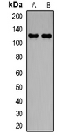 SLC4A4 / NBC1 Antibody - Western blot analysis of NBC1 expression in PC3 (A); A549 (B) whole cell lysates.