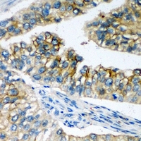 SLC4A4 / NBC1 Antibody - Immunohistochemical analysis of NBC1 staining in human prostate formalin fixed paraffin embedded tissue section. The section was pre-treated using heat mediated antigen retrieval with sodium citrate buffer (pH 6.0). The section was then incubated with the antibody at room temperature and detected using an HRP conjugated compact polymer system. DAB was used as the chromogen. The section was then counterstained with hematoxylin and mounted with DPX.