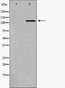 SLC4A4 / NBC1 Antibody - Western blot analysis of A549 whole cells lysates using SLC4A4 antibody. The lane on the left is treated with the antigen-specific peptide.