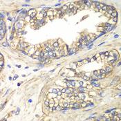 SLC4A4 / NBC1 Antibody - Immunohistochemistry of paraffin-embedded Human prostate using SLC4A4 / NBC Polyclonal Antibody at dilution of 1:100 (40x lens).