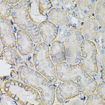 SLC4A4 / NBC1 Antibody - Immunohistochemistry of paraffin-embedded Mouse kidney using SLC4A4 / NBC Polyclonal Antibody at dilution of 1:100 (40x lens).