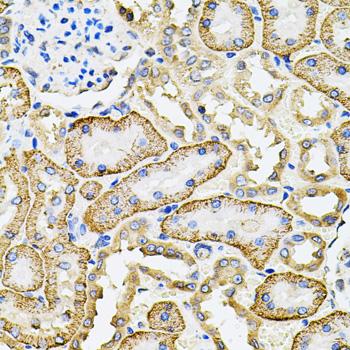 SLC4A4 / NBC1 Antibody - Immunohistochemistry of paraffin-embedded Rat kidney using SLC4A4 / NBC Polyclonal Antibody at dilution of 1:100 (40x lens).