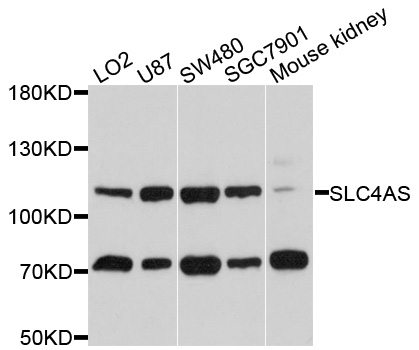 SLC4A5 / NBC4 Antibody - Western blot analysis of extracts of various cell lines, using SLC4A5 antibody at 1:1000 dilution. The secondary antibody used was an HRP Goat Anti-Rabbit IgG (H+L) at 1:10000 dilution. Lysates were loaded 25ug per lane and 3% nonfat dry milk in TBST was used for blocking. An ECL Kit was used for detection and the exposure time was 15s.