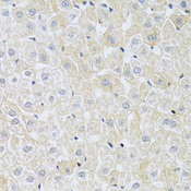SLC4A5 / NBC4 Antibody - Immunohistochemistry of paraffin-embedded rat liver using SLC4A5 antibodyat dilution of 1:100 (40x lens).