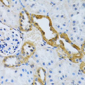 SLC4A5 / NBC4 Antibody - Immunohistochemistry of paraffin-embedded rat kidney using SLC4A5 antibodyat dilution of 1:100 (40x lens).