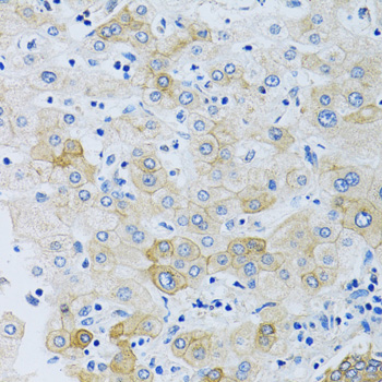 SLC4A5 / NBC4 Antibody - Immunohistochemistry of paraffin-embedded human liver using SLC4A5 antibodyat dilution of 1:100 (40x lens).