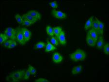 SLC4A5 / NBC4 Antibody - Immunofluorescence staining of HepG2 cells diluted at 1:133, counter-stained with DAPI. The cells were fixed in 4% formaldehyde, permeabilized using 0.2% Triton X-100 and blocked in 10% normal Goat Serum. The cells were then incubated with the antibody overnight at 4°C.The Secondary antibody was Alexa Fluor 488-congugated AffiniPure Goat Anti-Rabbit IgG (H+L).