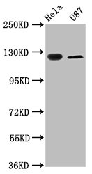 SLC4A5 / NBC4 Antibody - Western Blot Positive WB detected in: Hela whole cell lysate, U87 whole cell lysate All Lanes: SLC4A5 antibody at 2.7µg/ml Secondary Goat polyclonal to rabbit IgG at 1/50000 dilution Predicted band size: 127, 125, 116, 109, 108, 114, 119 KDa Observed band size: 127 KDa