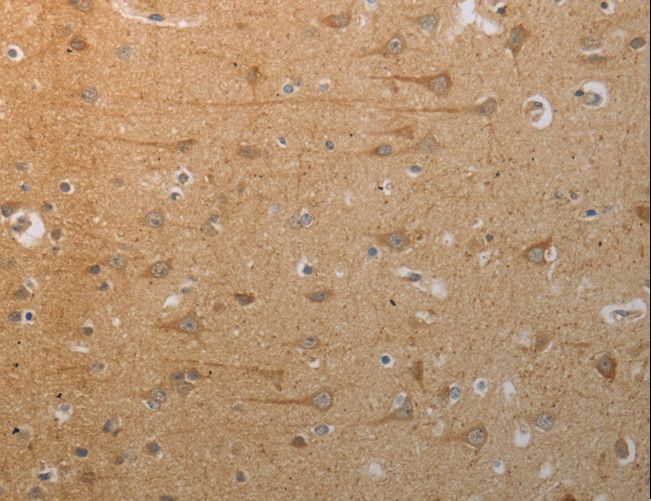 SLC4A7 Antibody - Immunohistochemistry of paraffin-embedded Human tonsil using SLC4A7 Polyclonal Antibody at dilution of 1:50.