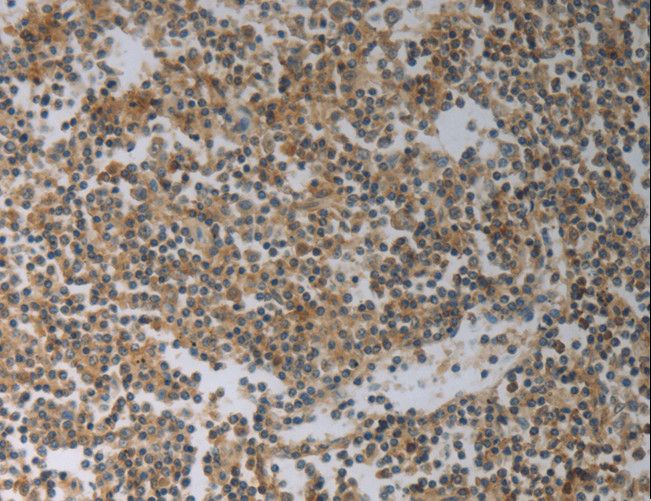 SLC4A7 Antibody - Immunohistochemistry of paraffin-embedded Human tonsil using SLC4A7 Polyclonal Antibody at dilution of 1:50.