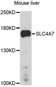 SLC4A7 Antibody - Western blot analysis of extracts of mouse liver, using SLC4A7 antibody at 1:1000 dilution. The secondary antibody used was an HRP Goat Anti-Rabbit IgG (H+L) at 1:10000 dilution. Lysates were loaded 25ug per lane and 3% nonfat dry milk in TBST was used for blocking. An ECL Kit was used for detection and the exposure time was 90s.