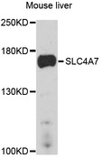 SLC4A7 Antibody - Western blot analysis of extracts of mouse liver, using SLC4A7 antibody at 1:1000 dilution. The secondary antibody used was an HRP Goat Anti-Rabbit IgG (H+L) at 1:10000 dilution. Lysates were loaded 25ug per lane and 3% nonfat dry milk in TBST was used for blocking. An ECL Kit was used for detection and the exposure time was 90s.