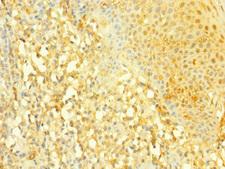 SLC4A7 Antibody - Immunohistochemistry of paraffin-embedded human tonsil tissue at dilution 1:100