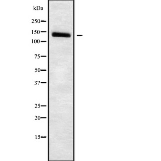 SLC4A7 Antibody - Western blot analysis SLC4A7 using HuvEc whole cells lysates