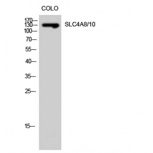 SLC4A8+10 Antibody - Western blot of SLC4A8/10 antibody