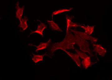 SLC4A8+10 Antibody - Staining COLO205 cells by IF/ICC. The samples were fixed with PFA and permeabilized in 0.1% Triton X-100, then blocked in 10% serum for 45 min at 25°C. The primary antibody was diluted at 1:200 and incubated with the sample for 1 hour at 37°C. An Alexa Fluor 594 conjugated goat anti-rabbit IgG (H+L) Ab, diluted at 1/600, was used as the secondary antibody.
