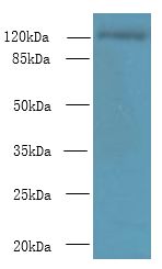 SLC4A8 / NBC Antibody - Western blot. All lanes: SLC4A8 antibody at 2 ug/ml+ HeLa whole cell lysate Goat polyclonal to rabbit at 1:10000 dilution. Predicted band size: 123 kDa. Observed band size: 123 kDa.