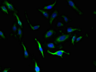 SLC4A8 / NBC Antibody - Immunofluorescent analysis of Hela cells using SLC4A8 Antibody at dilution of 1:100 and Alexa Fluor 488-congugated AffiniPure Goat Anti-Rabbit IgG(H+L)