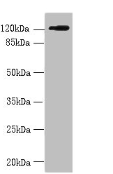 SLC4A8 / NBC Antibody - Western blot All lanes: SLC4A8 antibody at 2µg/ml + Hela whole cell lysate Secondary Goat polyclonal to rabbit IgG at 1/10000 dilution Predicted band size: 123, 121, 118, 112, 78, 84, 72 kDa Observed band size: 123 kDa