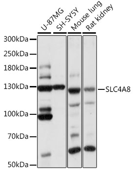 SLC4A8 / NBC Antibody - Western blot analysis of extracts of various cell lines, using SLC4A8 antibody at 1:1000 dilution. The secondary antibody used was an HRP Goat Anti-Rabbit IgG (H+L) at 1:10000 dilution. Lysates were loaded 25ug per lane and 3% nonfat dry milk in TBST was used for blocking. An ECL Kit was used for detection and the exposure time was 1s.