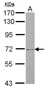 SLC4A8 / NBC Antibody - Sample (30 ug of whole cell lysate) A: U87-MG 7.5% SDS PAGE SLC4A8 antibody diluted at 1:1000