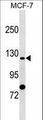 SLC4A9 / AE4 Antibody - SLC4A9 Antibody western blot of MCF-7 cell line lysates (35 ug/lane). The SLC4A9 antibody detected the SLC4A9 protein (arrow).