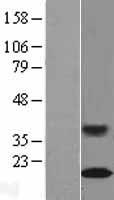 SLC50A1 / SCP Protein - Western validation with an anti-DDK antibody * L: Control HEK293 lysate R: Over-expression lysate