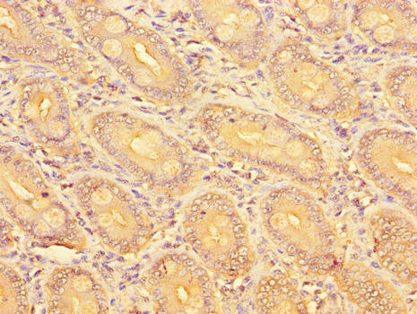 SLC51A / OSTalpha Antibody - Immunohistochemistry of paraffin-embedded human small intestine tissue using SLC51A Antibody at dilution of 1:100