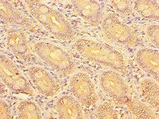 SLC51A / OSTalpha Antibody - Immunohistochemistry of paraffin-embedded human small intestine tissue using SLC51A Antibody at dilution of 1:100