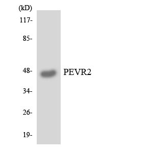 SLC52A1 / GPR172B / PAR2 Antibody - Western blot analysis of the lysates from K562 cells using PEVR2 antibody.