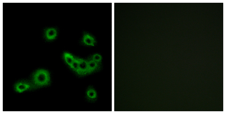 SLC52A1 / GPR172B / PAR2 Antibody - Immunofluorescence analysis of MCF7 cells, using PEVR2 Antibody. The picture on the right is blocked with the synthesized peptide.