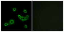 SLC52A1 / GPR172B / PAR2 Antibody - Immunofluorescence analysis of MCF7 cells, using PEVR2 Antibody. The picture on the right is blocked with the synthesized peptide.