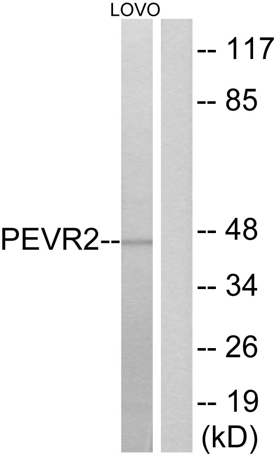 SLC52A1 / GPR172B / PAR2 Antibody - Western blot analysis of lysates from LOVO cells, using PEVR2 Antibody. The lane on the right is blocked with the synthesized peptide.
