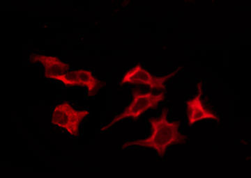 SLC52A1 / GPR172B / PAR2 Antibody - Staining LOVO cells by IF/ICC. The samples were fixed with PFA and permeabilized in 0.1% Triton X-100, then blocked in 10% serum for 45 min at 25°C. The primary antibody was diluted at 1:200 and incubated with the sample for 1 hour at 37°C. An Alexa Fluor 594 conjugated goat anti-rabbit IgG (H+L) Ab, diluted at 1/600, was used as the secondary antibody.