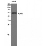 SLC52A2 / GPR172A / PAR1 Antibody - Western blot of GPR172A antibody